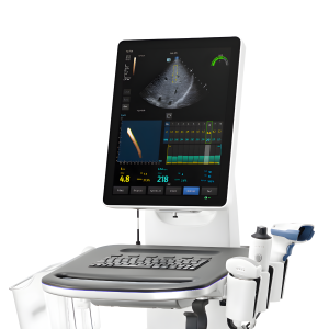 balón gástrico ajustable spatz3 – pérdida de peso no invasiva