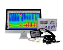 Manometría anorectal y esofágica para el estudio de la motilidad gastrointestinal. Diagnóstico preciso de trastornos funcionales del esófago y región anorectal.